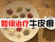 银屑病的治疗方法有什么